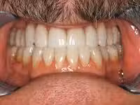 Konig Center for Cosmetic & Comprehensive Dentistry smile photos